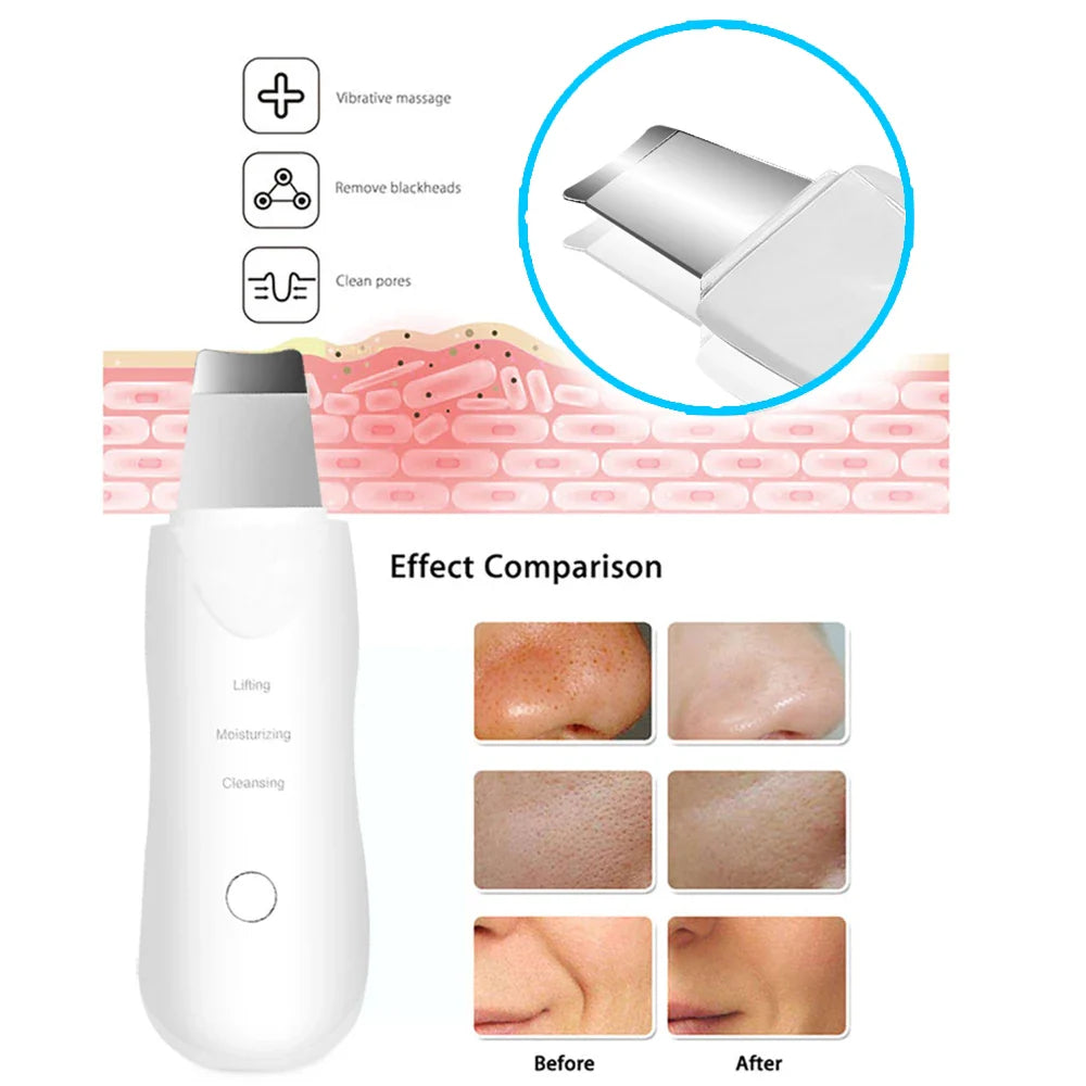 Ultrasonic Skin Scrubber™